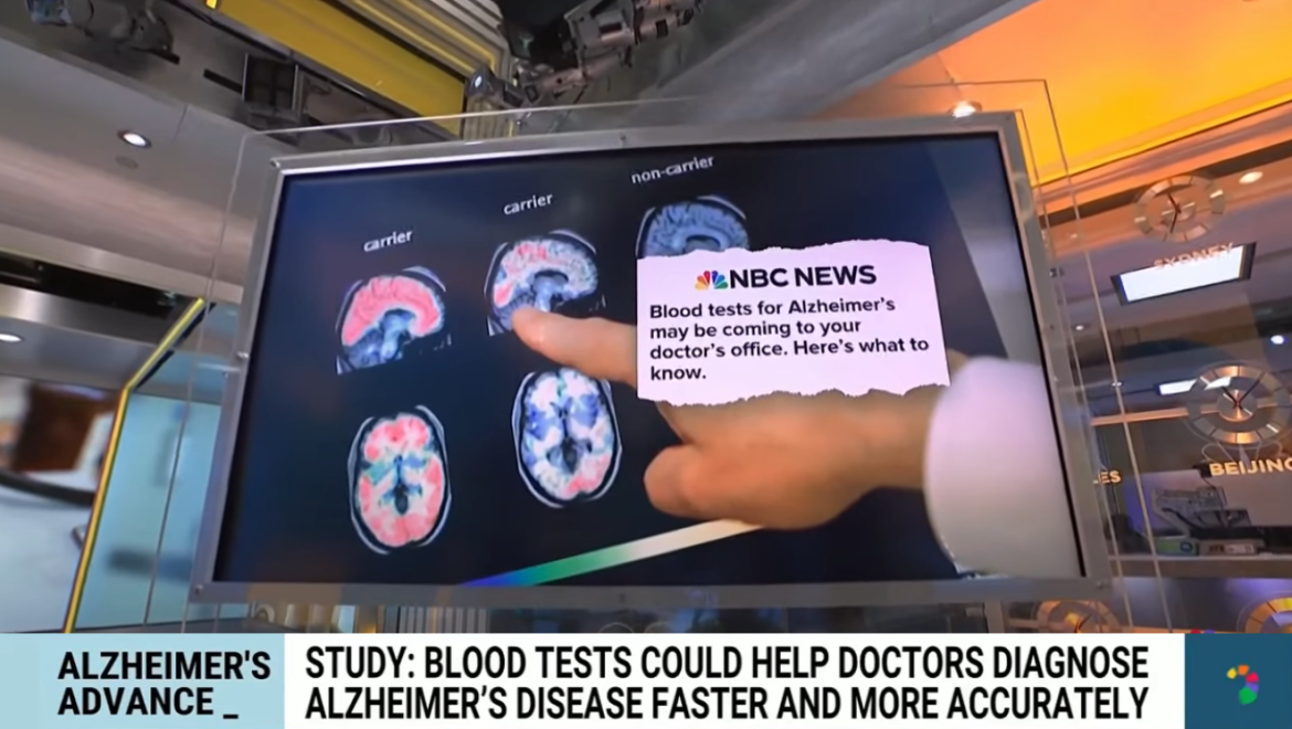 New Blood Test Revolutionizes Early Diagnosis of Alzheimer's