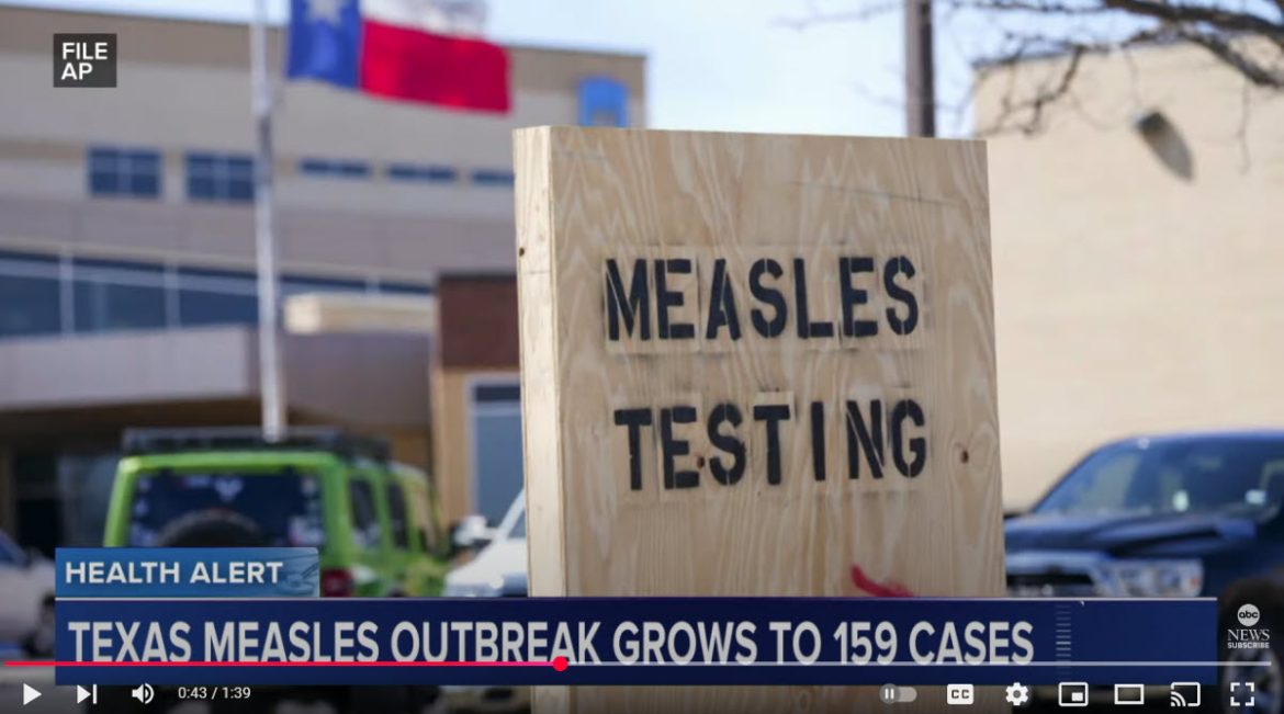Measles Outbreak in Texas Escalates to 159 Cases, Prompting Urgent Public Health Response